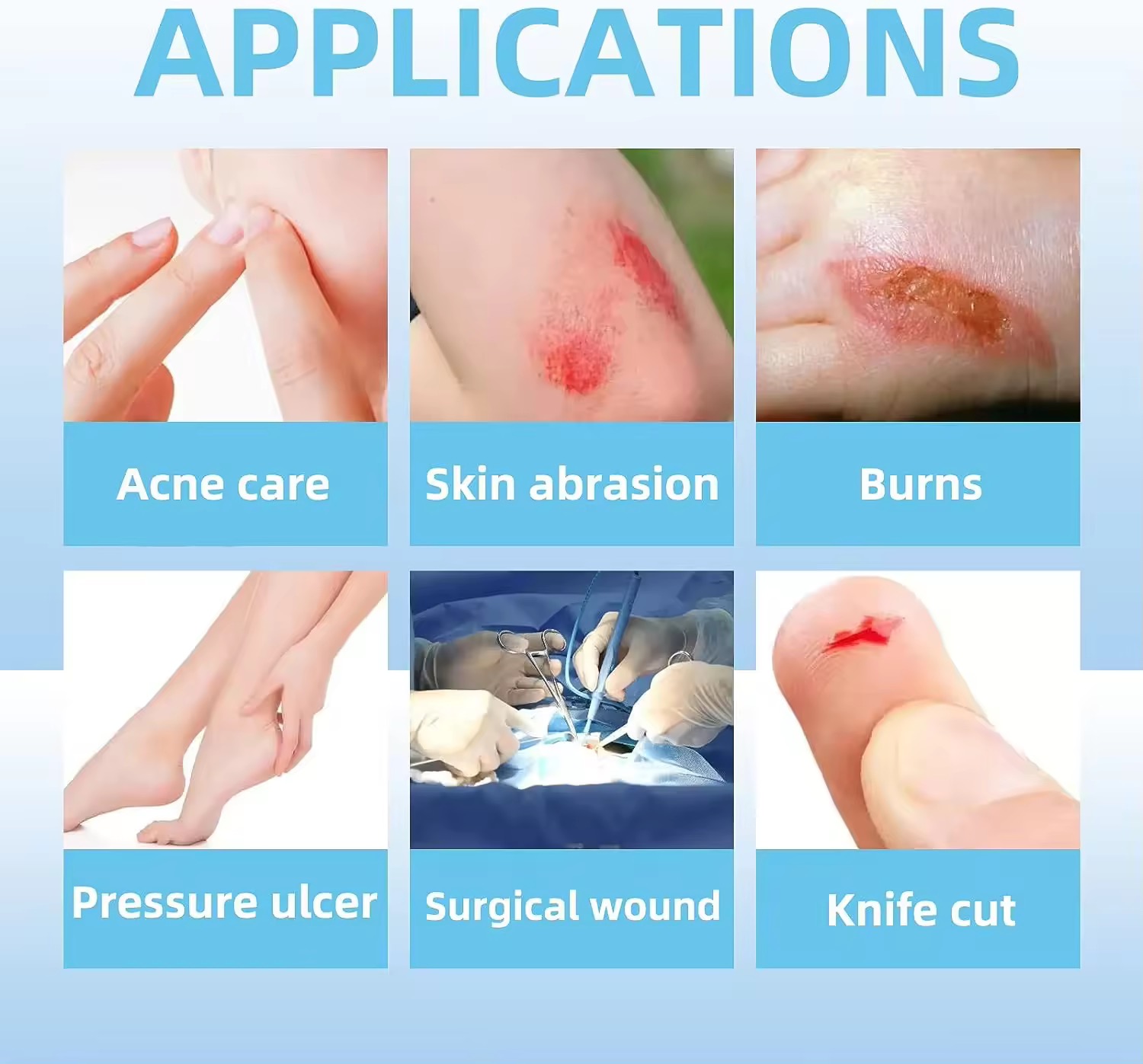 Wound Plaster